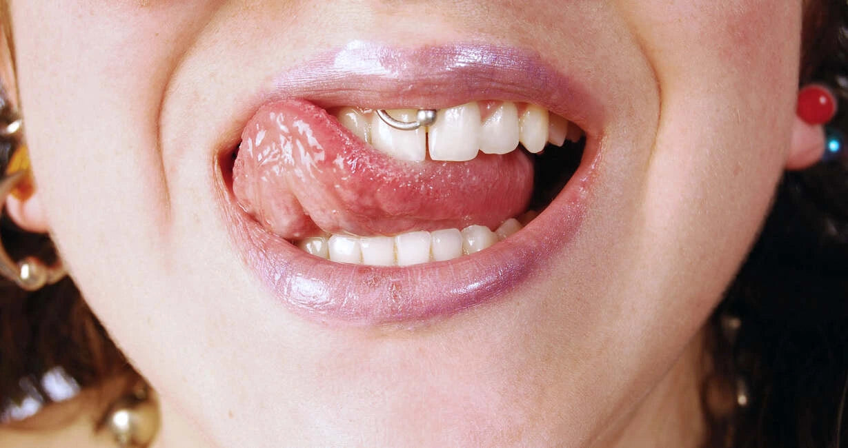Close-up of a person's mouth with visible smiley piercing