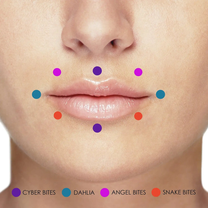 Close-up of a person's lips with colored dots labeled 'Cyber Bites', 'Dahlia', 'Angel Bites', and 'Snake Bites'.